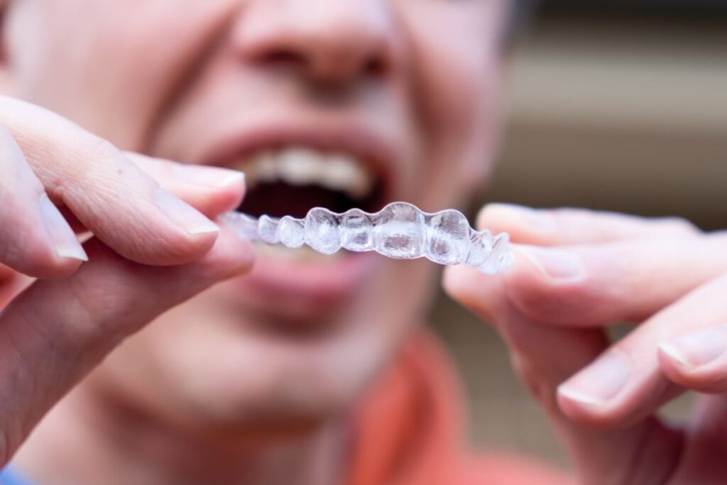 How to Care for Your Invisalign Aligners
