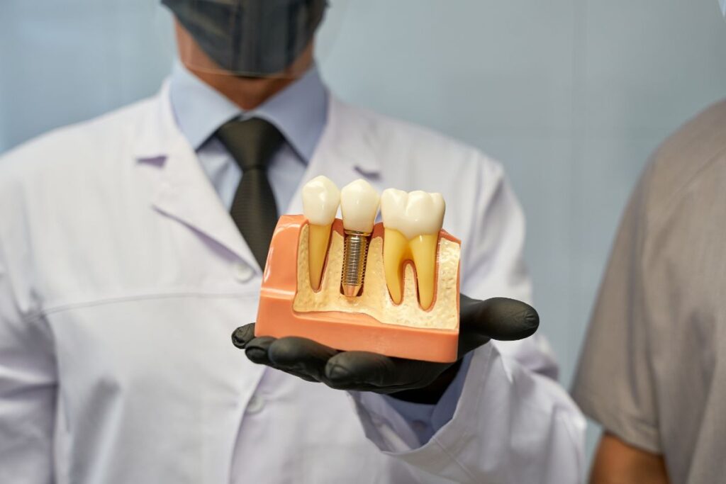 Can You Get Dental Implants If You Have Bone Loss? What You Need to Know