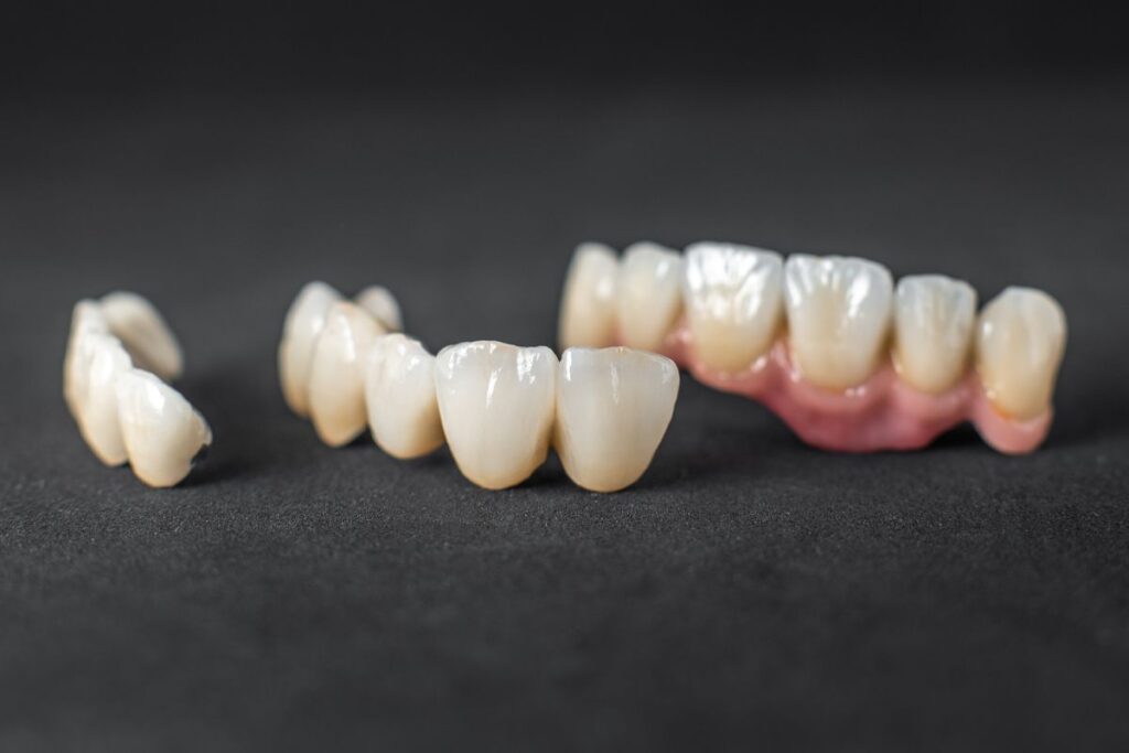How Strong Are Same-Day Dental Crowns? Our Dentist Explains