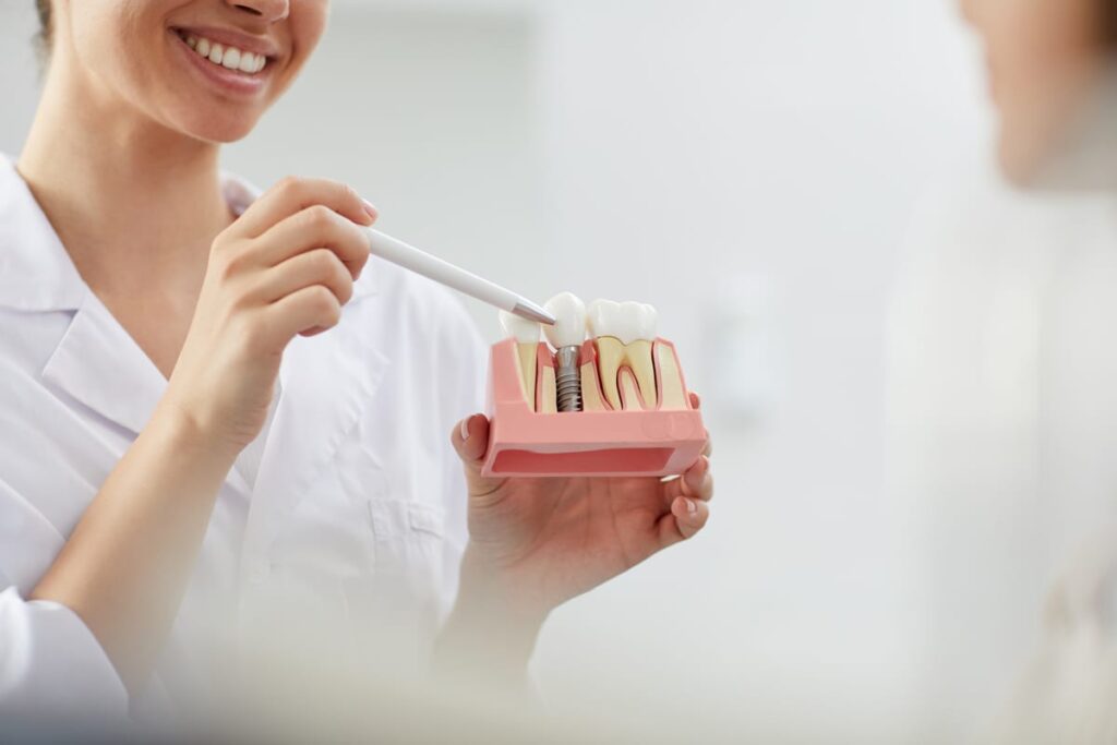 Dental Implants vs. Dentures: Which Option Fits Your Life